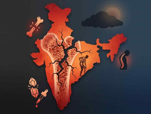 India's Silent Epidemic – The Deepening Calcium and Vitamin D Crisis-Wisekhabar India's Silent Epidemic – The Deepening Calcium and Vitamin D Crisis